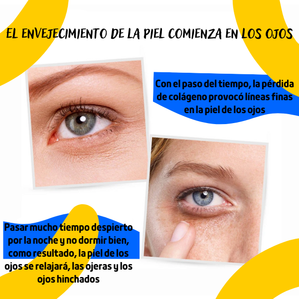 PARCHES PARA OJOS™ Dile adiós a tus ojeras